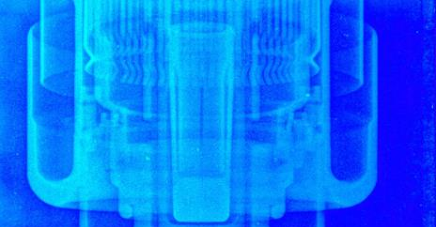 Digital Radiography (DR)